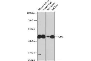 Western blot analysis of extracts of various cell lines using TOM1 Polyclonal Antibody at dilution of 1:3000. (TOM1 抗体)