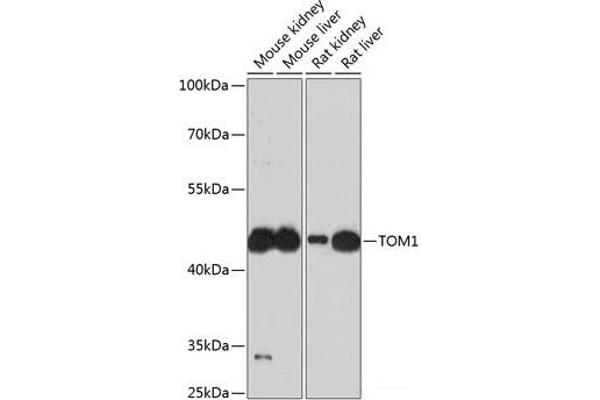 TOM1 抗体