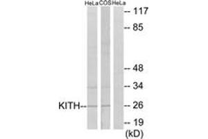 Western Blotting (WB) image for anti-Thymidine Kinase 1, Soluble (TK1) (AA 161-210) antibody (ABIN2889377) (TK1 抗体  (AA 161-210))