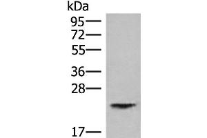 Western blot analysis of Human kidney tissue lysate using HEBP1 Polyclonal Antibody at dilution of 1:750 (HEBP1 抗体)