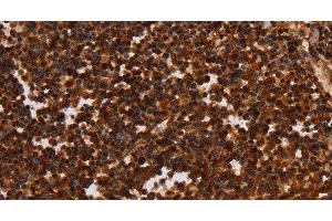 Immunohistochemistry of paraffin-embedded Human tonsil tissue using ALG11 Polyclonal Antibody at dilution 1:40 (ALG11 抗体)
