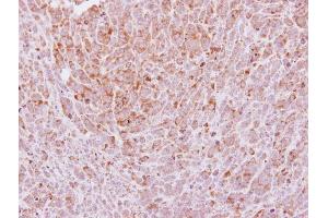IHC-P Image Immunohistochemical analysis of paraffin-embedded BT483 xenograft, using Laminin gamma 2, antibody at 1:250 dilution. (LAMC2 抗体)
