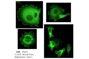 Immunofluorescence (IF) image for anti-Neural Precursor Cell Expressed, Developmentally Down-Regulated 9 (NEDD9) (AA 82-398) antibody (ABIN108573)