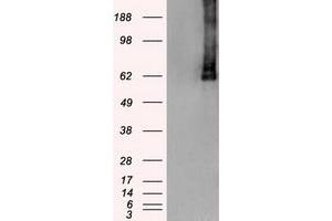 HEK293T cells were transfected with the pCMV6-ENTRY control (Left lane) or pCMV6-ENTRY PLK1 (Right lane) cDNA for 48 hrs and lysed. (PLK1 抗体)