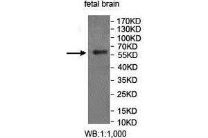 Western blot analysis of fetal brain lysate, using FUCA2 antibody. (FUCA2 抗体  (AA 312-467))