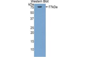 Detection of Recombinant HSPA1L, Human using Polyclonal Antibody to Heat Shock 70 kDa Protein 1 Like Protein (HSPA1L) (HSPA1L 抗体  (AA 1-641))