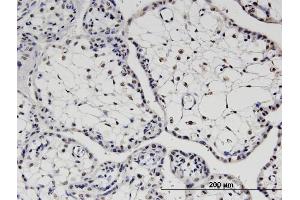 Immunoperoxidase of monoclonal antibody to TBX22 on formalin-fixed paraffin-embedded human placenta. (T-Box 22 抗体  (AA 431-519))