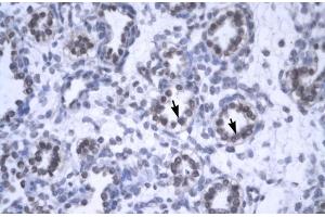 Rabbit Anti-YEATS4 Antibody  Paraffin Embedded Tissue: Human Lung Cellular Data: Alveolar cells Antibody Concentration: 4. (GAS41 抗体  (Middle Region))