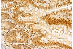 ABIN6257621 and ABIN6275320 at 1/100 staining Rat colon tissue by IHC-P. (NCOA4 抗体  (C-Term))
