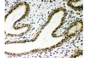 Immunohistochemistry (IHC) image for anti-ATP Synthase, H+ Transporting, Mitochondrial Fo Complex, Subunit D (ATP5H) (AA 2-161) antibody (ABIN3043795)