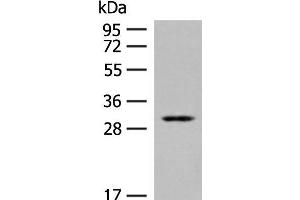 Western blot analysis of Human kidney tissue lysate using TPMT Polyclonal Antibody at dilution of 1:400 (TPMT 抗体)