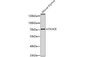 Western blot analysis of extracts of Mouse thymus using FANCE Polyclonal Antibody at dilution of 1:1000. (FANCE 抗体)