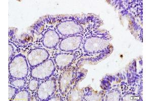 Formalin-fixed and paraffin embedded rat colitis tissue labeled with Anti-Phospho-IRAK1 (Thr209) Polyclonal Antibody, Unconjugated  at 1:200 followed by conjugation to the secondary antibody and DAB staining