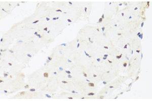 Immunohistochemistry of paraffin-embedded Rat heart using IRF3 Polyclonal Antibody at dilution of 1:100 (40x lens). (IRF3 抗体)