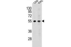 Western Blotting (WB) image for anti-Melanin-Concentrating Hormone Receptor 1 (MCHR1) antibody (ABIN2995780) (MCHR1 抗体)