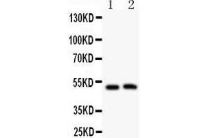 Anti- MIP antibody, Western blotting All lanes: Anti MIP  at 0. (Mip (AA 246-263), (C-Term) 抗体)