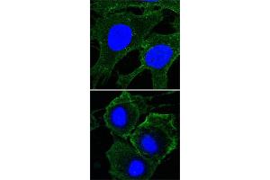 Confocal immunofluorescence analysis of HeLa (upper) and HepG2 (bottom) cells using KDR monoclonal antibody, clone 4B4  (green) . (VEGFR2/CD309 抗体)