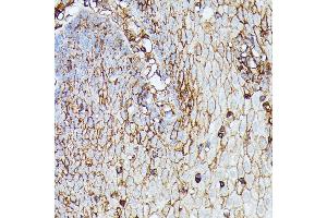 Immunohistochemistry of paraffin-embedded human esophageal using HLA-B antibody (ABIN1513015, ABIN3021868, ABIN3021869 and ABIN6216628) at dilution of 1:100 (40x lens). (HLA-B 抗体  (AA 1-100))
