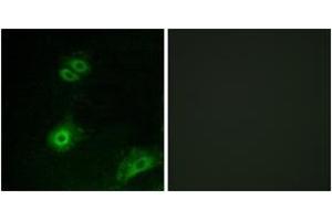 Immunofluorescence analysis of A549 cells, using OR4A16 Antibody. (OR4A16 抗体  (AA 261-310))