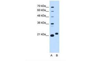 Image no. 1 for anti-Chromosome 1 Open Reading Frame 159 (C1orf159) (AA 93-142) antibody (ABIN6738341)