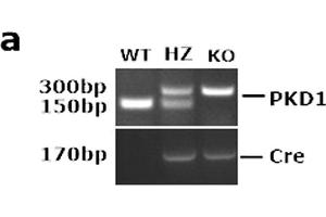 PKD1 was deleted specifically in transgenic mice. (SP7 抗体  (AA 331-431))