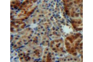 Used in DAB staining on fromalin fixed paraffin-embedded kidney tissue (IGFBP5 抗体  (AA 25-271))