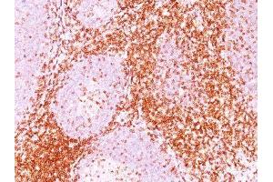 Image no. 2 for anti-CD6 (CD6) antibody (ABIN6160102) (CD6 抗体)