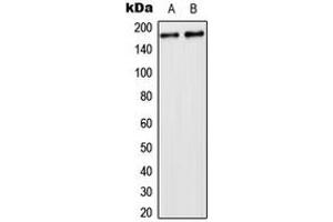Western blot analysis of USP32 expression in HeLa (A), NIH3T3 (B) whole cell lysates. (USP32 抗体  (Center))