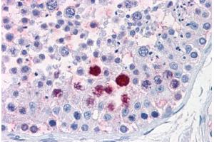 Human Testis: Formalin-Fixed, Paraffin-Embedded (FFPE) (ENPP3 抗体  (C-Term))