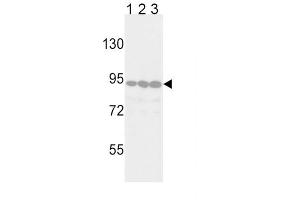 Western blot analysis of TYRO10 Antibody in Jurkat (lane 1), 293 (lane 2) and Hela (lane 3) cell line lysates (35 ug/lane). (DDR2 抗体)