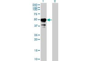 Western Blotting (WB) image for anti-Signal Transducing Adaptor Molecule (SH3 Domain and ITAM Motif) 1 (STAM) (AA 1-404) antibody (ABIN466125)
