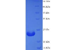Immunogenic Protein MPT64 (AA 24-228) protein (His tag)