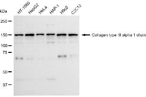 Western blotting analysis using Collagen type III alpha 1 chain antibody (ABIN7798126).