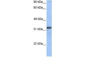 ETFA antibody used at 1 ug/ml to detect target protein. (ETFA 抗体)