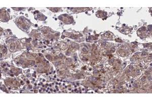 Immunohistochemistry (IHC) image for anti-Olfactory Receptor, Family 51, Subfamily M, Member 1 (OR51M1) (C-Term) antibody (ABIN6259542)