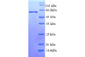 SDS-PAGE (SDS) image for Leucine Rich Repeat and Ig Domain Containing 1 (LINGO1) (AA 37-555) protein (His tag) (ABIN5711887)