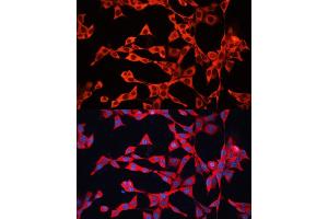 Immunofluorescence analysis of NIH/3T3 cells using GDI2 antibody (ABIN6129647, ABIN6141048, ABIN6141049 and ABIN7101828) at dilution of 1:100. (GDI2 抗体  (AA 296-445))