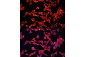 Immunofluorescence analysis of NIH/3T3 cells using GDI2 antibody (ABIN6129647, ABIN6141048, ABIN6141049 and ABIN7101828) at dilution of 1:100. (GDI2 抗体  (AA 296-445))