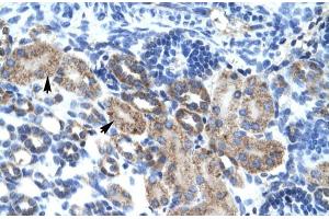 Human kidney; CGI-62 antibody - C-terminal region in Human kidney cells using Immunohistochemistry (FAM164A 抗体  (C-Term))