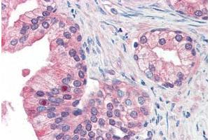 Human Prostate (formalin-fixed, paraffin-embedded) stained with MFI2 antibody ABIN351428 at 15 ug/ml followed by biotinylated goat anti-rabbit IgG secondary antibody ABIN481713, alkaline phosphatase-streptavidin and chromogen.