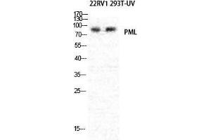 Western Blot (WB) analysis of specific cells using PML Polyclonal Antibody. (PML 抗体  (N-Term))