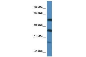WB Suggested Anti-SERBP1 Antibody Titration:  0. (SERBP1 抗体  (C-Term))