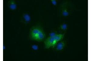 Anti-LIPG mouse monoclonal antibody (ABIN2453246) immunofluorescent staining of COS7 cells transiently transfected by pCMV6-ENTRY LIPG (RC209248). (LIPG 抗体)