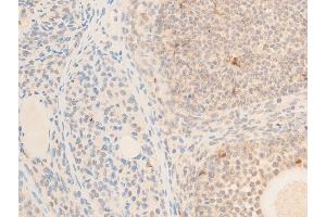 ABIN6256492 and ABIN6267236 at 1/100 staining rat ovarian tissue sections by IHC-P.