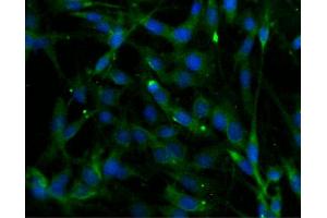 Immunofluorescent staining of C6 cells (Rat glioma, ATCC CCL-107) (right). (Phospholipase C beta 4 抗体  (AA 752-961))