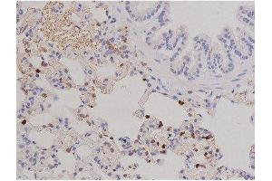 ABIN6267606 at 1/200 staining Rat lung tissue sections by IHC-P. (FAK 抗体  (pTyr576))
