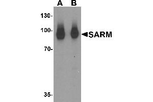 Western blot analysis of SARM in human kidney tissue lysate with SARM antibody at (A) 1 and (B) 2 µg/mL. (SARM1 抗体  (N-Term))