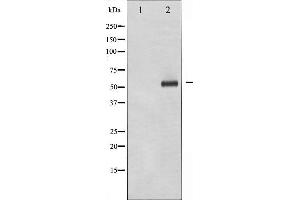 Western blot analysis of p56 Dok-2 phosphorylation expression in K562 whole cell lysates,The lane on the left is treated with the antigen-specific peptide. (DOK2 抗体  (pTyr299))
