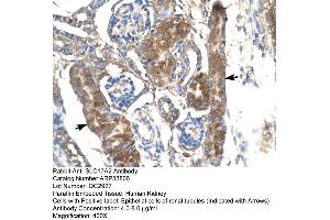 Human kidney (SLC17A2 抗体  (Middle Region))