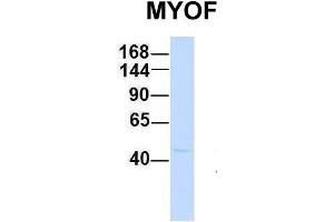 Myoferlin Antikörper  (C-Term)